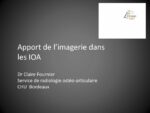 Apport de l’imagerie dans les IOA (radiographie, échographie, TDM, IRM)