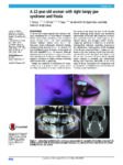 A 22-year-old woman with right lumpy jaw syndrome and fistula