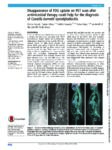 Disappearance of FDG uptake on PET scan after antimicrobial therapy could help for the diagnosis of Coxiella burnetii spondylodiscitis