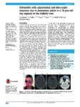 Ethmoiditis with subperiosteal and retro-ocular abscesses due to Aeromonas sobria in a 16-year-old boy exposed to the Ardèche river