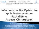 ISO après instrumentation rachidienne : aspects chirurgicaux