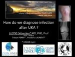 How do we diagnose infection after UKA ?