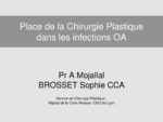 Place de la chirurgie plastique et reconstructrice dans les ostéites, pseudarthroses septiques et infections de PTG