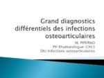 Grands diagnostics différentiels des IOA (maladies inflammatoires, microcristallines, etc.)