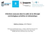 Infection et chirurgie cancer/metastase