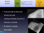 Cas clinique N°5