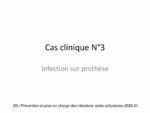 Cas clinique N°3 : Infection sur prothèse