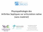 Physiopathologie des Arthrites Septiques sur articulation native (sans matériel)