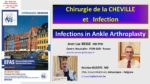 Infections et prothèse de cheville