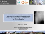 Les indications de résection-arthroplastie