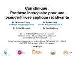 Prothèse intercalaire pour une pseudarthrose septique récidivante