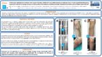 Arthroscopic Debridement Antibiotic And Implant Retention (DAIR) with local administration of Exebacase (Lysin CF-301) (LysinDAIR) followed by suppressive tedizolid as salvage therapy in elderly patients for relapsing multidrug-resistant Staphylococcus epidermidis prosthetic knee infection