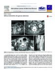 Diffuse Escherichia coli gaseous abscesses